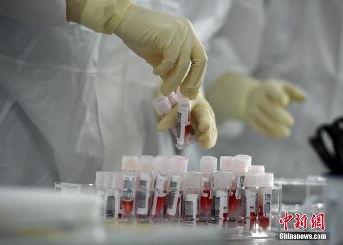 实验室工作人员整理刚刚送来的经预处理后的样本。a target='_blank' href='http://www.chinanews.com/'中新社/a记者 侯宇 摄