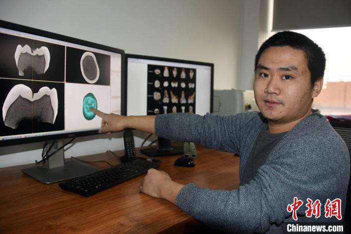 邢松研究员介绍对梅铺古人类牙齿化石进行显微断层扫描(micro-CT)相关情况。孙自法摄 邢松研究员介绍对梅铺古人类牙齿化石进行显微断层扫描(micro-CT)相关情况。孙自法摄