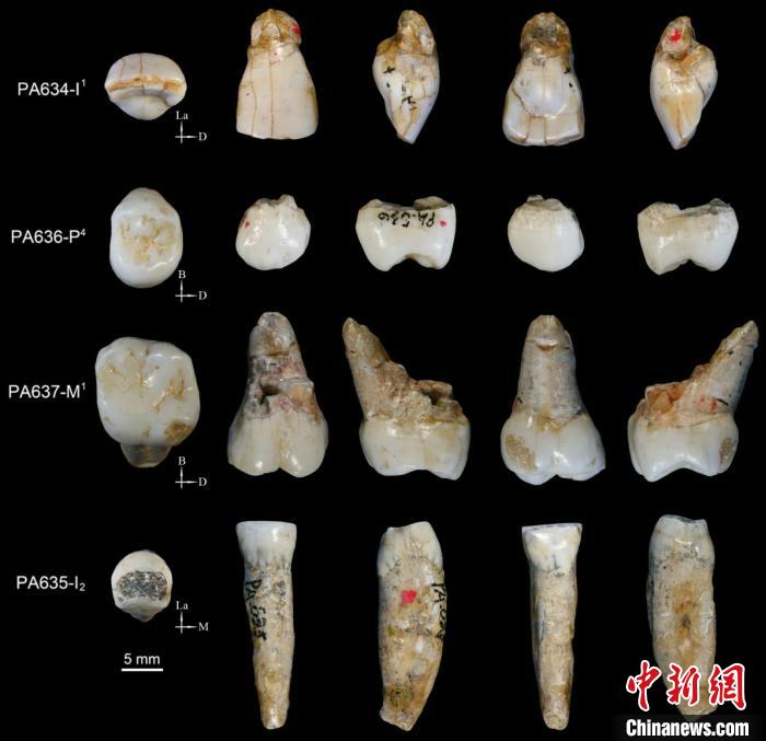 梅铺古人类牙齿。邢松 供图 梅铺古人类牙齿。邢松 供图