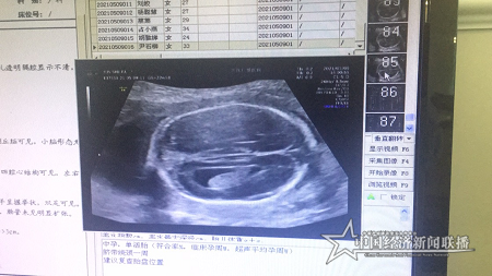 仁爱2.png
